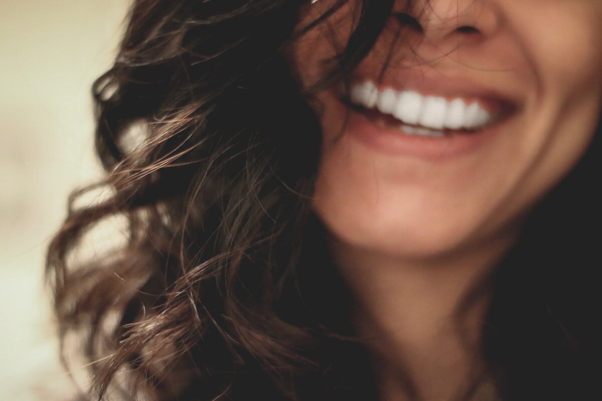 Sorriso branco após clareamento dental